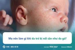 ảnh chụp màn hình bé bị nổi da gà