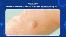 ảnh chụp màn hình bệnh da gà ở tay