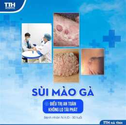 ảnh chụp màn hình bệnh viện da liễu hà nội chữa sùi mào gà