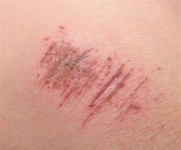 ảnh chụp màn hình bị trầy da có được ăn thịt gà