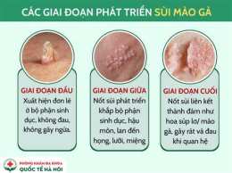 ảnh chụp màn hình da bị sùi mào gà