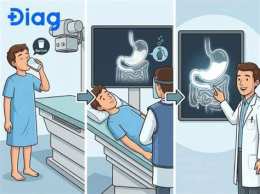 ảnh chụp màn hình dạ dày gà có bao nhiêu túi