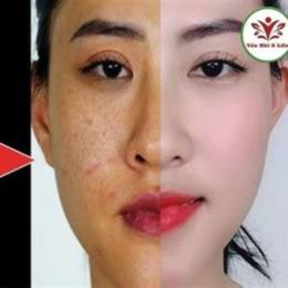 cách dưỡng da bằng lòng đỏ trứng gà