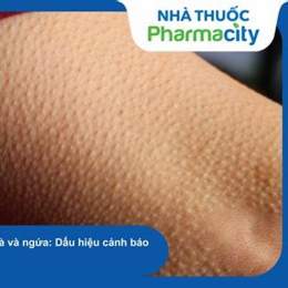 da be bị nổi sần như da gà