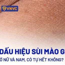 da bị sùi mào gà