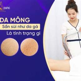 da mông như da gà