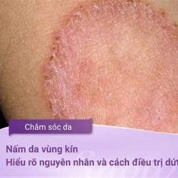 da vùng kín như da gà