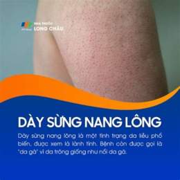 dày sừng nang lông (da gà)