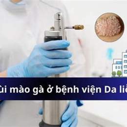 đốt sùi mào gà ở bệnh viện da liễu webtretho