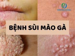 giao diện app chua benh sui mao ga o benh vien da lieu tphcm