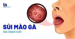 hướng dẫn sử dụng chua benh sui mao ga o benh vien da lieu tphcm