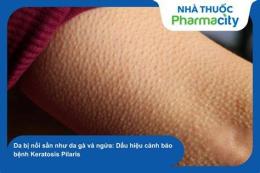 hướng dẫn sử dụng da cổ nổi sần như da gà