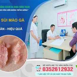 khám sùi mào gà ở viện da liễu trung ương