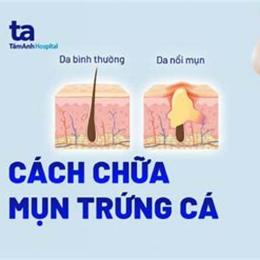 làm sao để hết da gà