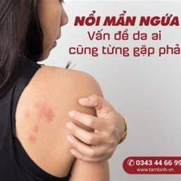 mẩn ngứa nổi da gà