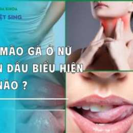 mao mang ga da