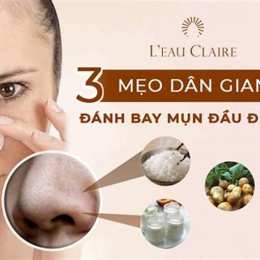 mụn đầu đen gần