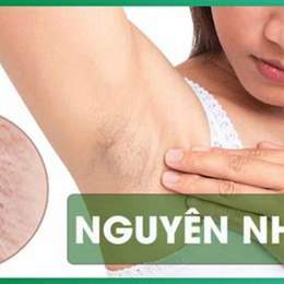 nách sần da gà