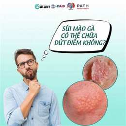 những người đã chữa khỏi sùi mào gà