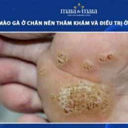 sùi mào gà khám ở đâu tại đà lạt