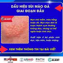 sui mao ga o da