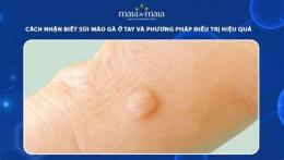 tính năng nổi bật bé sốt mà sởn da gà ở tay
