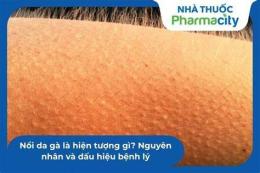 tính năng nổi bật bệnh da gà là gì