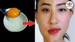 tính năng nổi bật cách làm trắng da bằng lòng trắng trứng gà