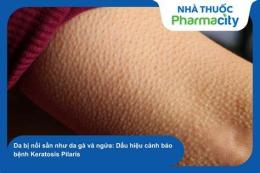 tính năng nổi bật da bị sần sùi như da gà ngứa