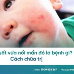trẻ bị sốt và nổi da gà