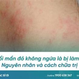 triệu chứng ớn lạnh nổi da gà